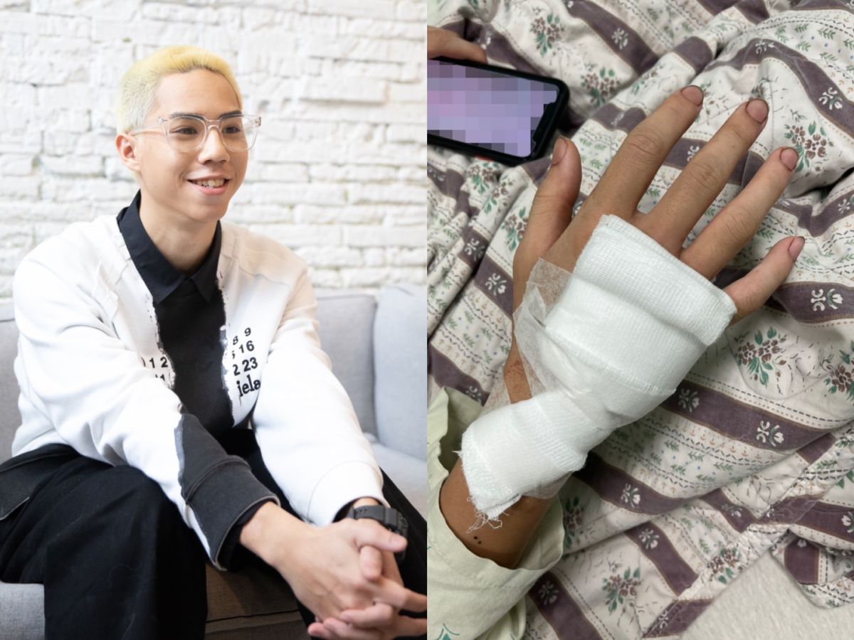 ▲街舞男團B.T.O.D成員Kenny（左圖）自摔骨折，傷勢曝光。（圖／寬寬整合行銷提供）