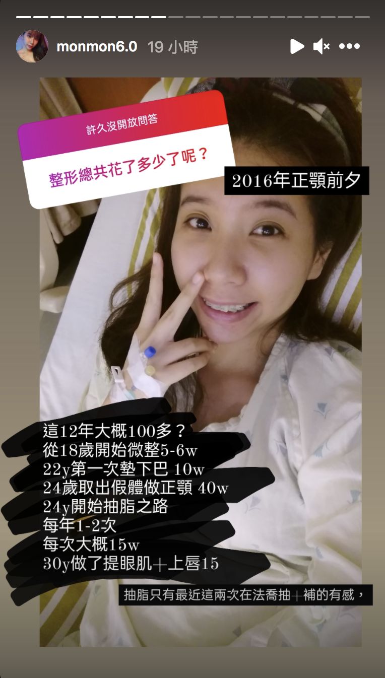 ▲吳夢夢公開整形前的照片。(圖/吳夢夢IG)