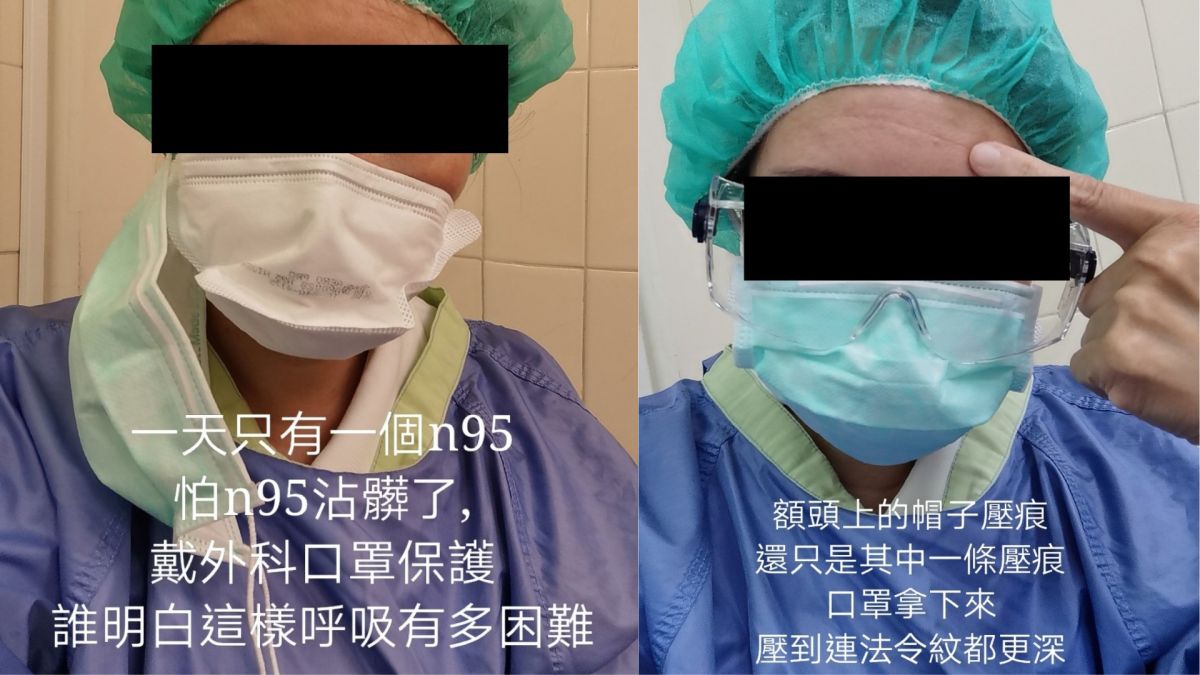 ▲醫護人員整整戴8小時的口罩和手套、隔離衣，臉上滿滿的壓痕。（翻攝自《爆怨2公社》）