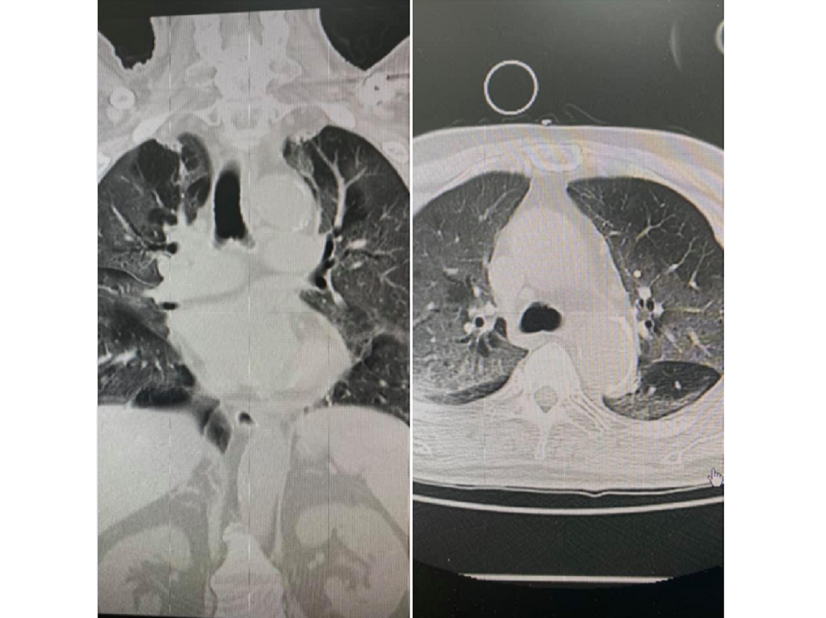▲急診科醫師柯世祐在臉書表示，現在要插管的病患太多，他擔憂「再一兩個禮拜，台北、新北的ECMO（葉克膜）會不會就用完了呢？」並直喊「我很怕，我彷彿就坐在奈何橋旁，目擊著一個一個走上橋的人」。（圖／翻攝自柯世祐臉書）