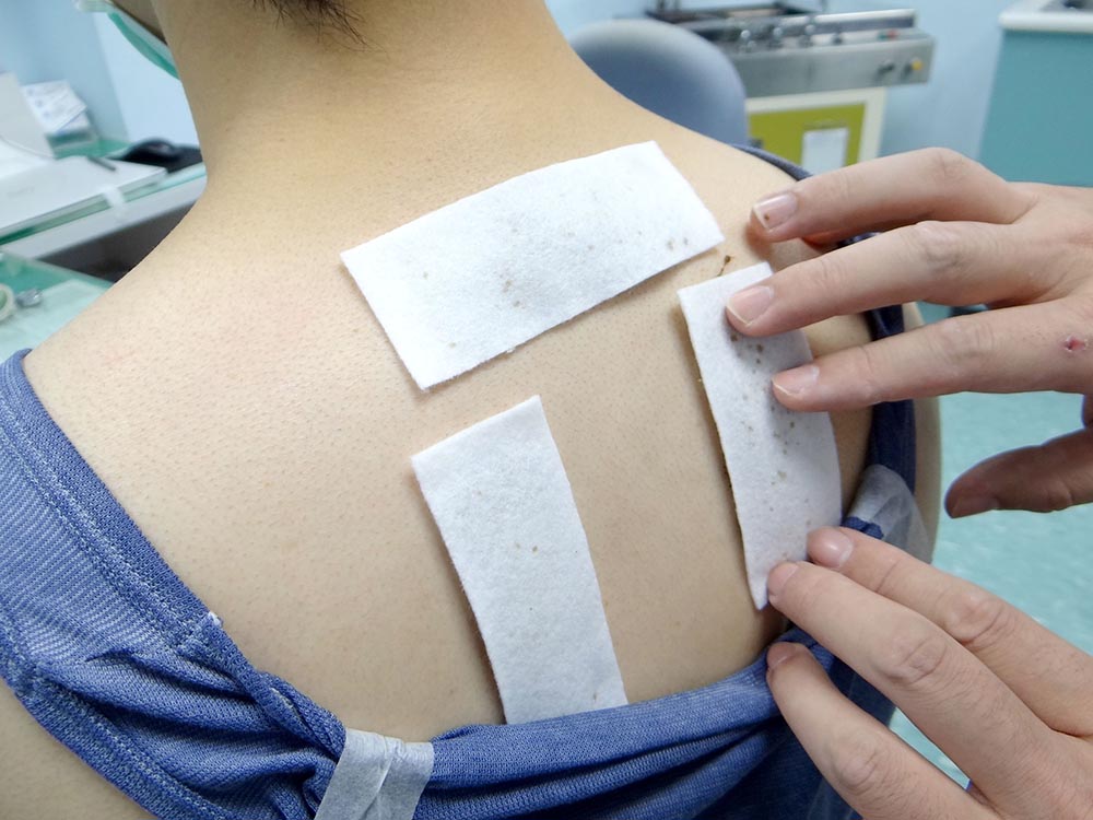 ▲台北市市立聯合醫院仁愛院區中醫師王明仁表示，三伏貼療法是透過將溫熱藥物直接敷貼在穴位上，提振體內陽氣並驅除寒氣，具有增強免疫提升代謝的功效，對於虛寒性體質的患者的後遺症具有不錯的療效。（圖／NOWnews資料照片）