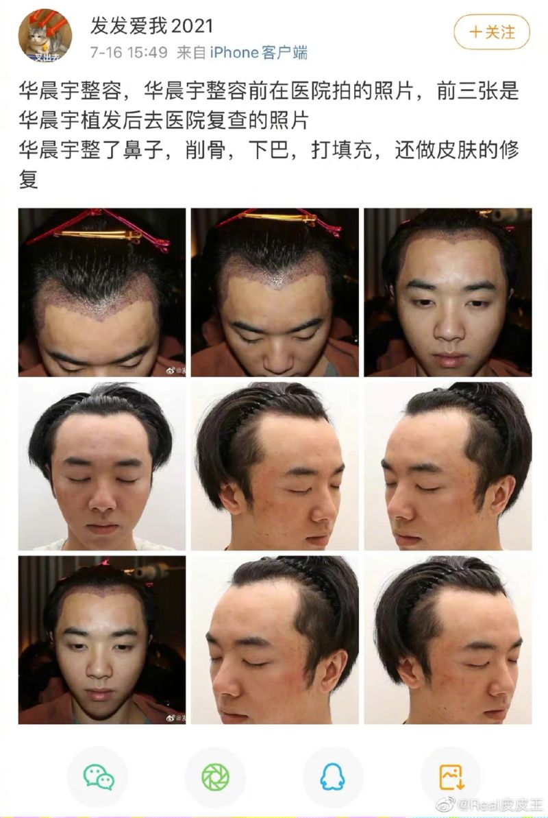 ▲網友稱是華晨宇整形前的照片。(圖/翻攝發發愛我2021微博)