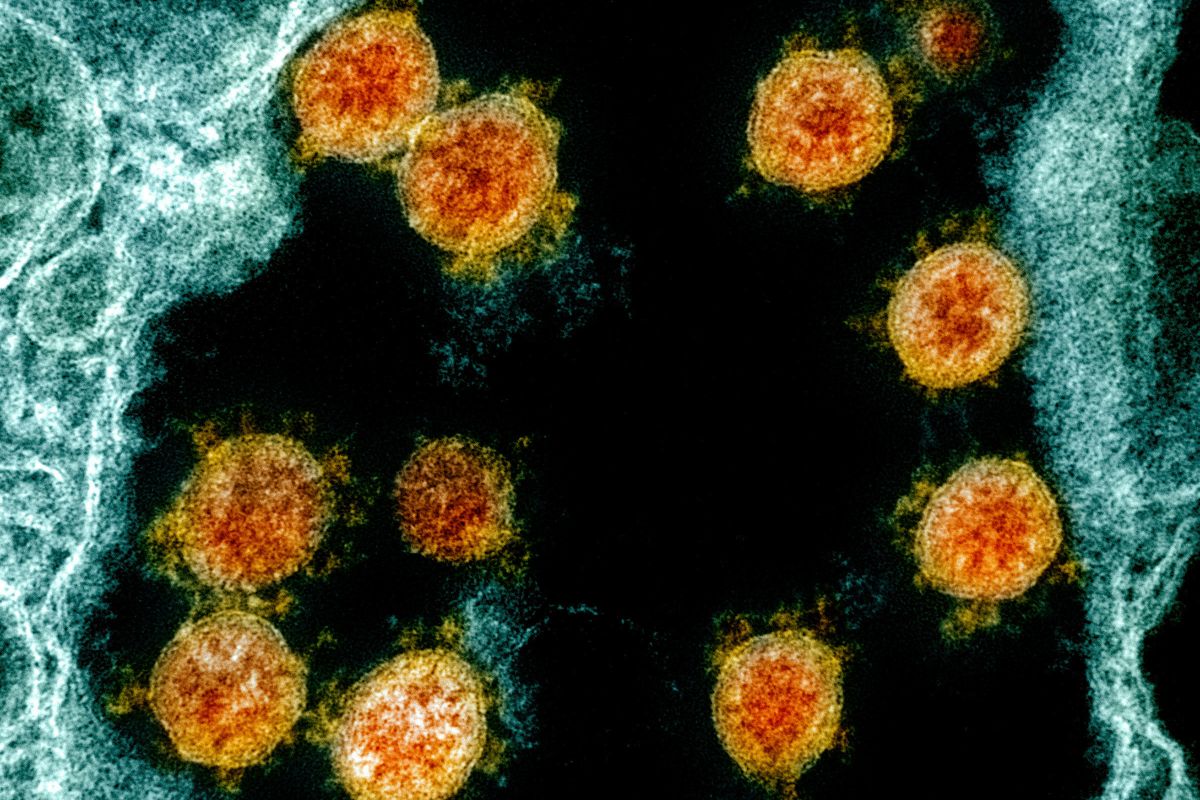 ▲最新研究指出，人類細胞上的唾液酸醣脂結構，會協助新冠病毒與細胞結合，使人染疫。（示意圖／美聯社／達志影像）