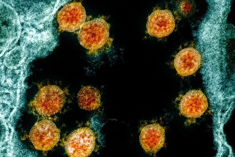 ▲研究團隊指出，人類在感染新冠肺炎之後，體內病毒抗體能夠至少存續7個月。（圖／美聯社／達志影像）