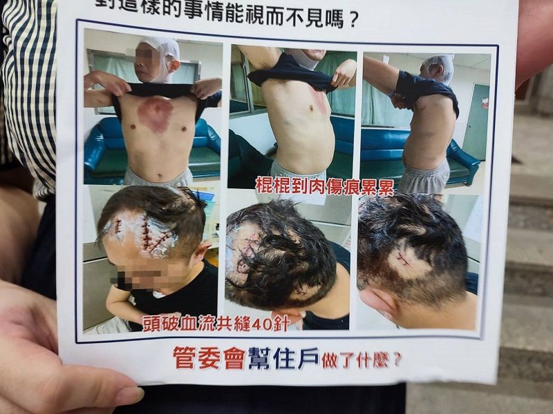 ▲鄭姓住戶遭保全員毆打成傷(圖/記者鄧力軍翻攝)