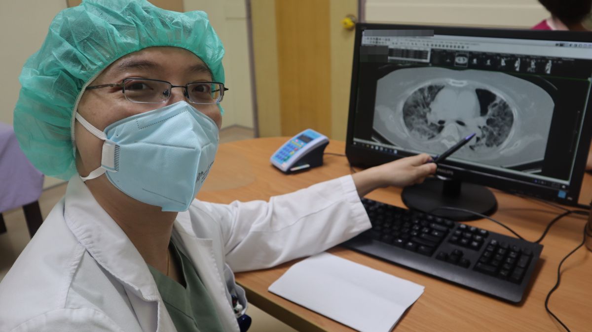 ▲臺北醫院胸腔內科醫師蕭詠聰指出，新冠肺炎重症病人出院後，因肺部纖維化，需要使用製氧機進行心肺功能的復健。（圖／衛生福利部臺北醫院提供）