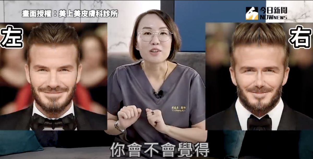 ▲左右臉對稱，到底會不會比較好看呢？（圖／美上美皮膚科診所   授權）