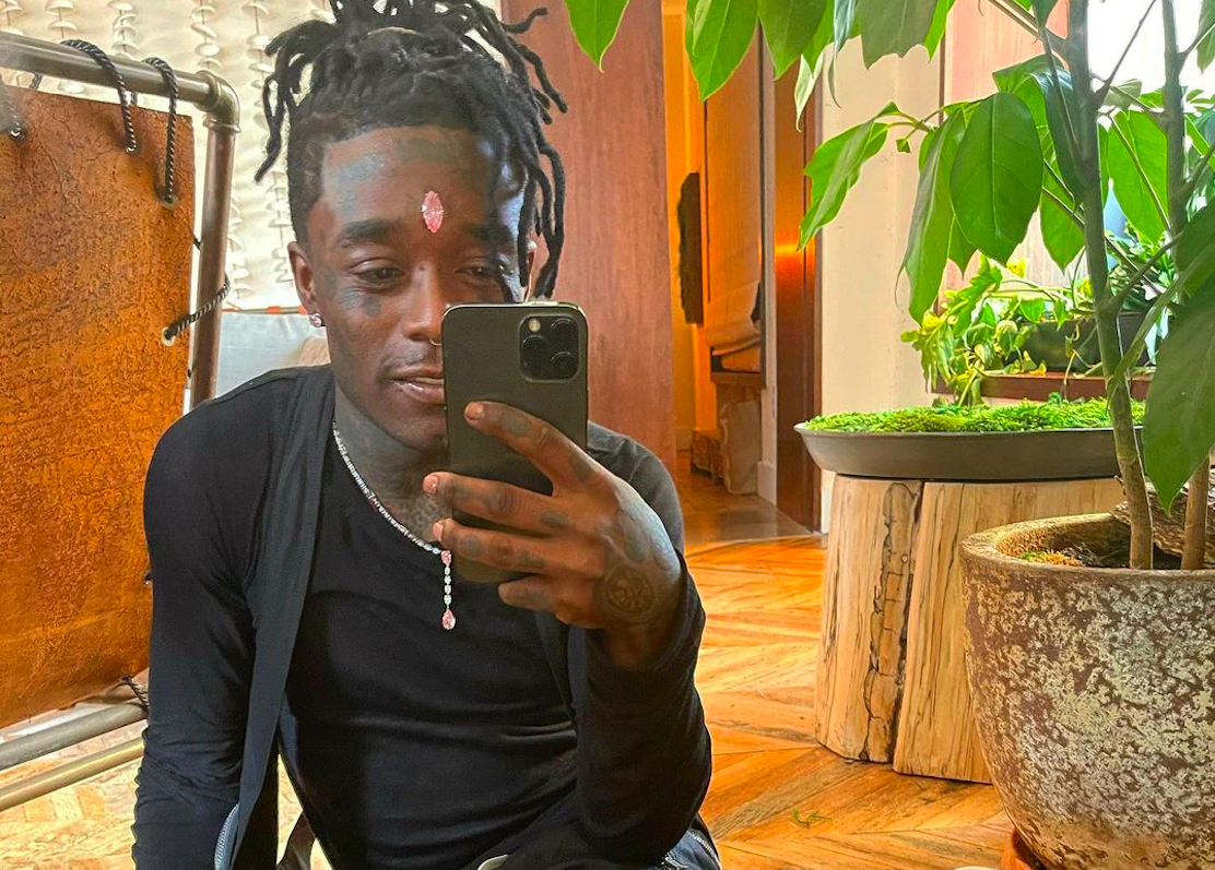 ▲Lil Uzi Vert額頭上要價6.7億元的粉紅色鑽石，遭熱情粉絲扯下。（圖／翻攝Lil Uzi Vert臉書）