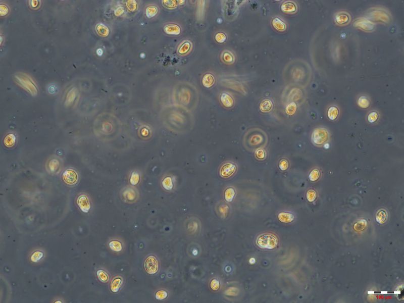 ▲顯微鏡（400倍）下放大觀測藻種為隱藻。（圖／高雄市環保局提供）