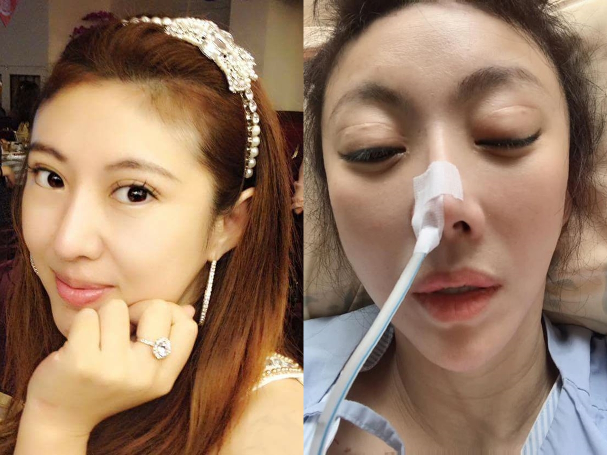 ▲李宇柔去年因腸爆裂開刀，至今身體仍有隱憂。（圖／翻攝李宇柔臉書）