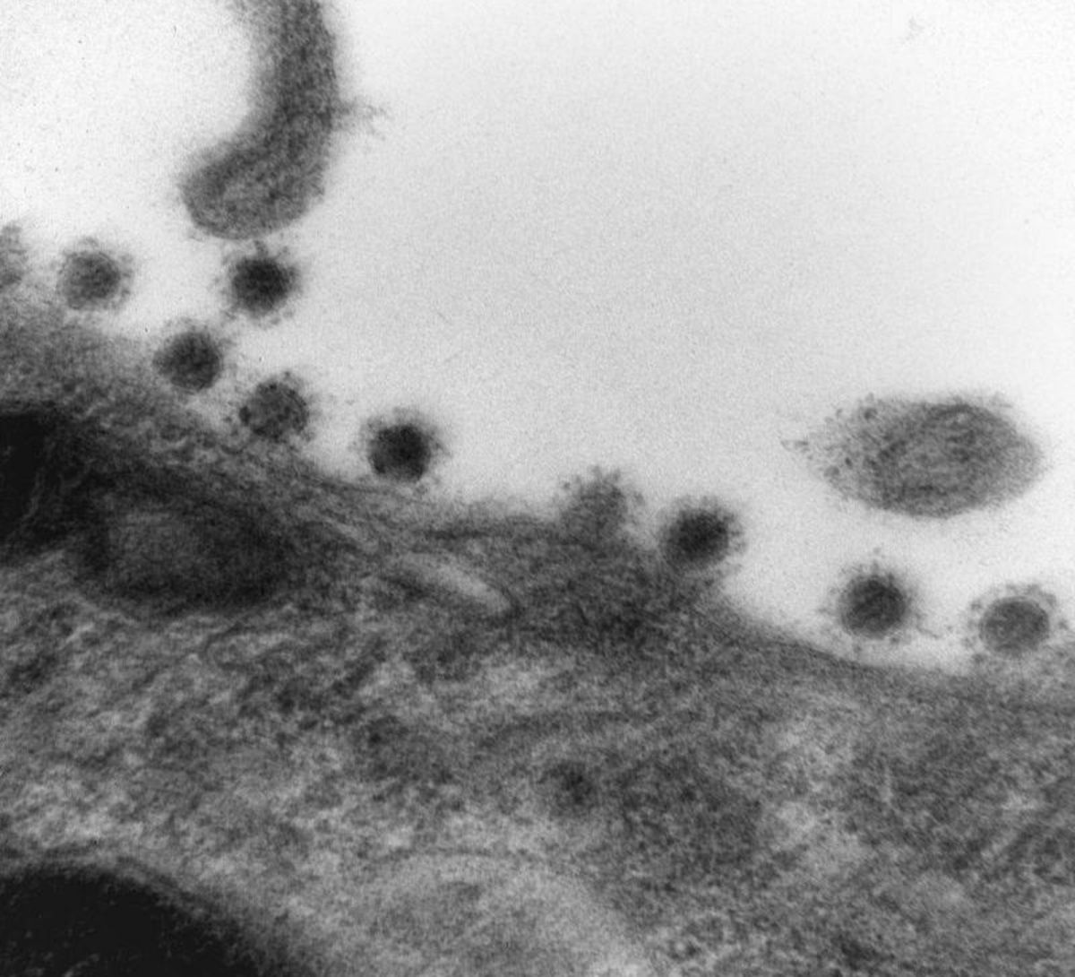 ▲俄羅斯科學家公布電子顯微鏡下的Delta病毒照片。（圖／翻攝自Sputnik官網）