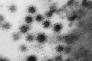 ▲▼俄羅斯科學家公布電子顯微鏡下的Delta病毒照片。（圖／翻攝自Sputnik官網）