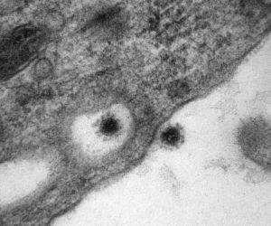 ▲▼俄羅斯科學家公布電子顯微鏡下的Delta病毒照片。（圖／翻攝自Sputnik官網）