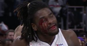 ▲Isaiah Stewart被打中臉部。(圖/ESPN) ▲Isaiah Stewart被打中臉部。(圖/ESPN)