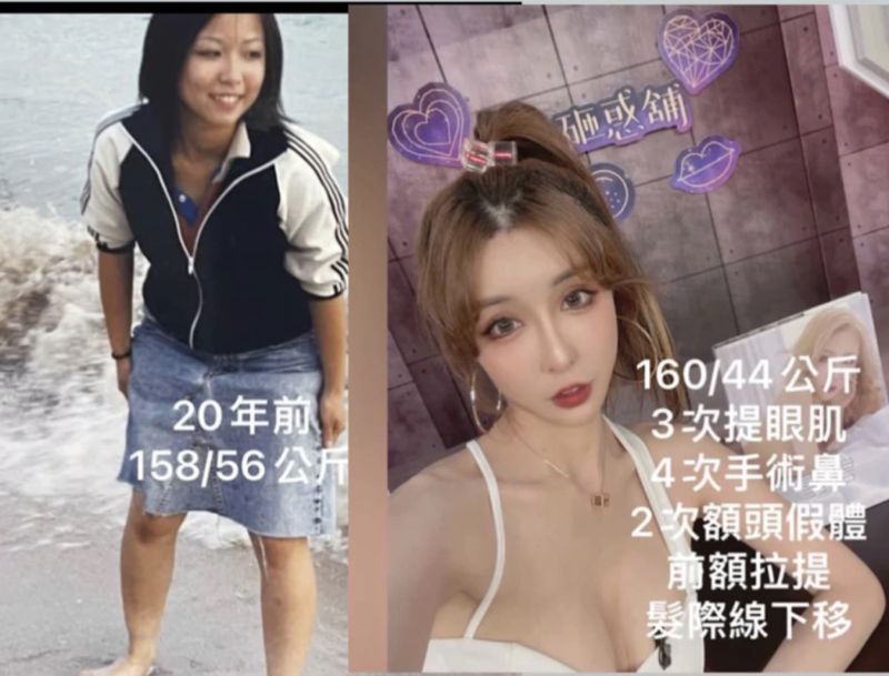 ▲雪碧曾公開整形前後對比照。(圖/雪碧臉書)
