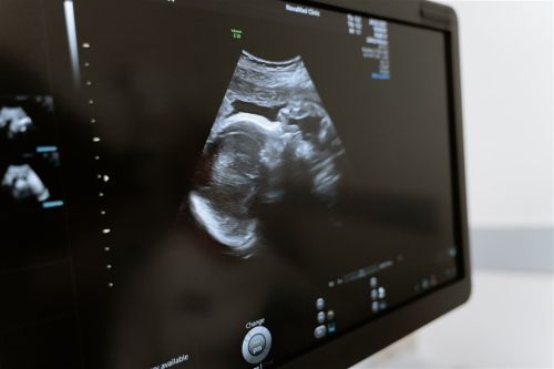 ▲日本境內13日首度出現實施胎內手術成功的案例，是對一名還在母親胎內、罹患重度主動脈瓣狹窄先天性心臟病的胎兒實施手術。（示意圖／翻攝自Pexels圖庫）