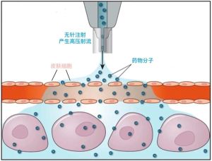 ▲中國研發國內首款無針疫苗接種機械臂。(圖/《青年報》) ▲中國研發國內首款無針疫苗接種機械臂。(圖/《青年報》)