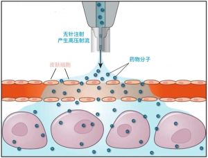 ▲中國研發國內首款無針疫苗接種機械臂。（圖／《青年報》）