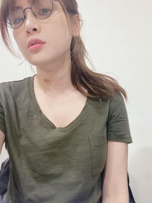▲陳沂除掉脖子紋路。(圖/陳沂臉書) ▲陳沂除掉脖子紋路。(圖/陳沂臉書)