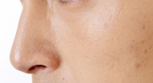 孩子猛一撞！30歲媽鼻骨折　醫示警1隱藏危機：很多人以為是小傷
