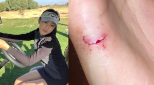 ▲人在美國的14歲宋智雅也受傷。(圖/朴妍秀IG) ▲人在美國的14歲宋智雅也受傷。(圖/朴妍秀IG)