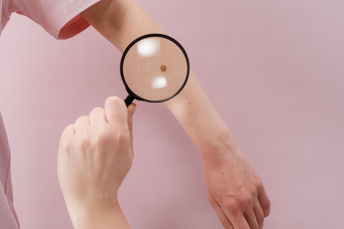 ▲從手相可以看出命運，不同位置的痣，也都藏有不同的涵義。（示意圖／取自unsplash）