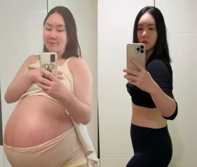 女星生3胞胎爆肥106公斤「走不動坐輪椅」　隔8月減34KG
