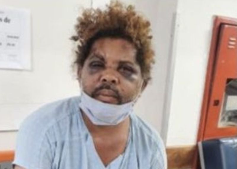 ▲巴西一名街友吉瓦爾多上月遭健身教練痛毆，過程還被監視器拍攝下來，結果卻意外爆紅。（圖/推特）