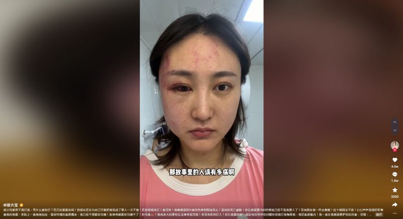 百萬網紅4次家暴險被打死 臉蛋變形「恐怖滲血照流出」