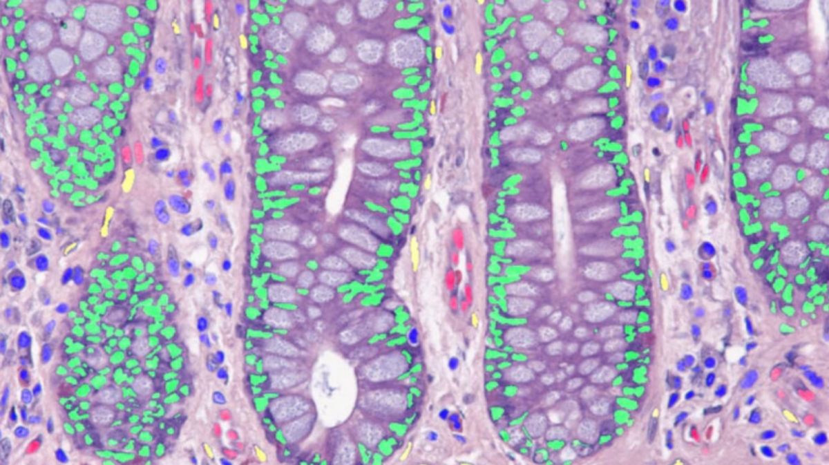 ▲跨國科學家團隊公布突破性「人體細胞圖譜」初稿。（圖／翻攝自自然期刊網站）