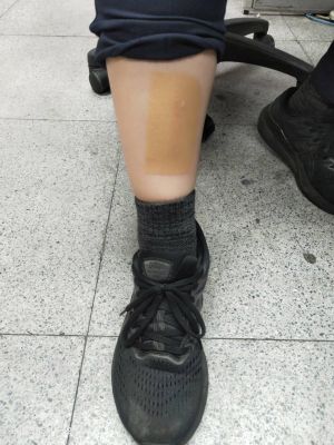 ▲警員趙蓓琳被撞手腳擦傷。（圖／翻攝畫面）