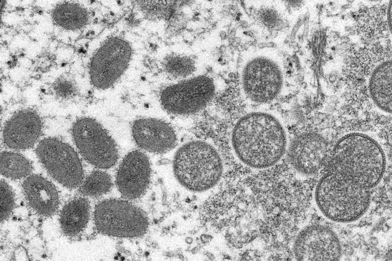 ▲全球多個國家陸續傳出猴痘感染病例，圖片中為顯微鏡下的猴痘病毒。（圖／美聯社／達志影像）