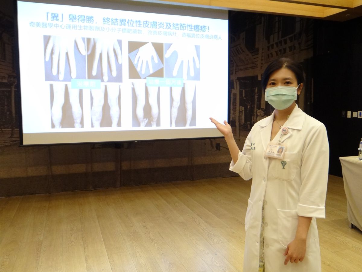 ▲奇美醫學中心皮膚科醫師鄭百珊表示，運用生物製劑及小分子標靶藥物，改善皮膚病灶，造福異位皮膚炎病人（圖／記者林怡孜攝，2022,06,09）