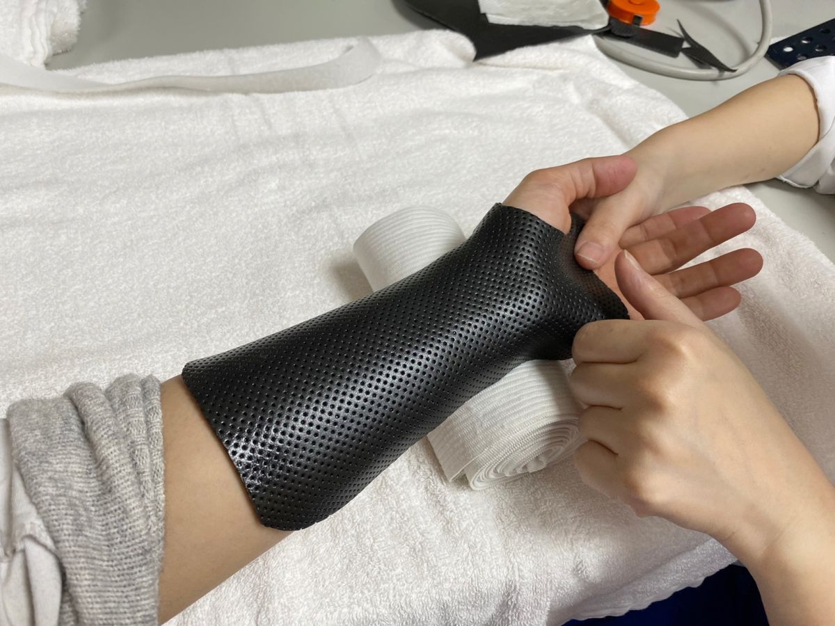 ▲部立台北醫院透露，有名核保員陳小姐每日努力趕辦相關作業，兩週前發現右手手腕及手掌感到麻、疼痛，手部疼痛持續時間越長，使用網購的手部護具也無法緩解。（圖／部北提供）