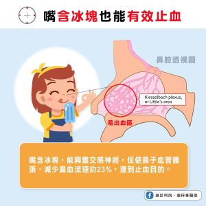 止鼻血時除了熱敷外,也可以搭配口含冰塊、冰棒。(圖/《急診柯南.翁梓華醫師》FB) ▲止鼻血時除了熱敷外,也可以搭配口含冰塊、冰棒。(圖/《急診柯南.翁梓華醫師》FB)