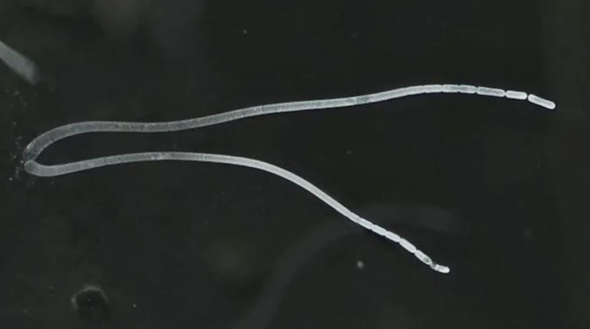 ▲科學家在加勒比海的法國屬地瓜德羅普（Guadeloupe）紅樹林發現世界最大的細菌，不僅肉眼可見，還可以用鑷子輕鬆夾起。（圖／翻攝自今日印度）