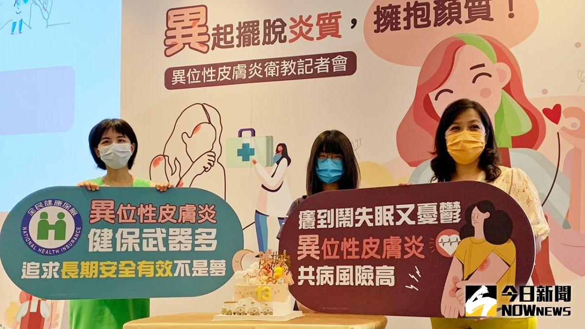 ▲「異位性皮膚炎」是一種慢性發炎性皮膚病，不具傳染性。（圖／記者陳美嘉攝，2022.07.05）