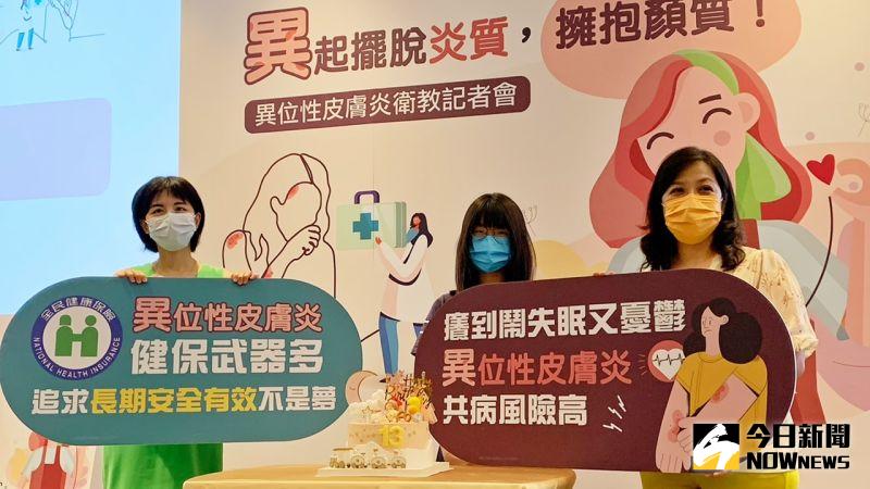 乾濕季節交替好發「異位性皮膚炎」　台灣每年37萬人就醫
