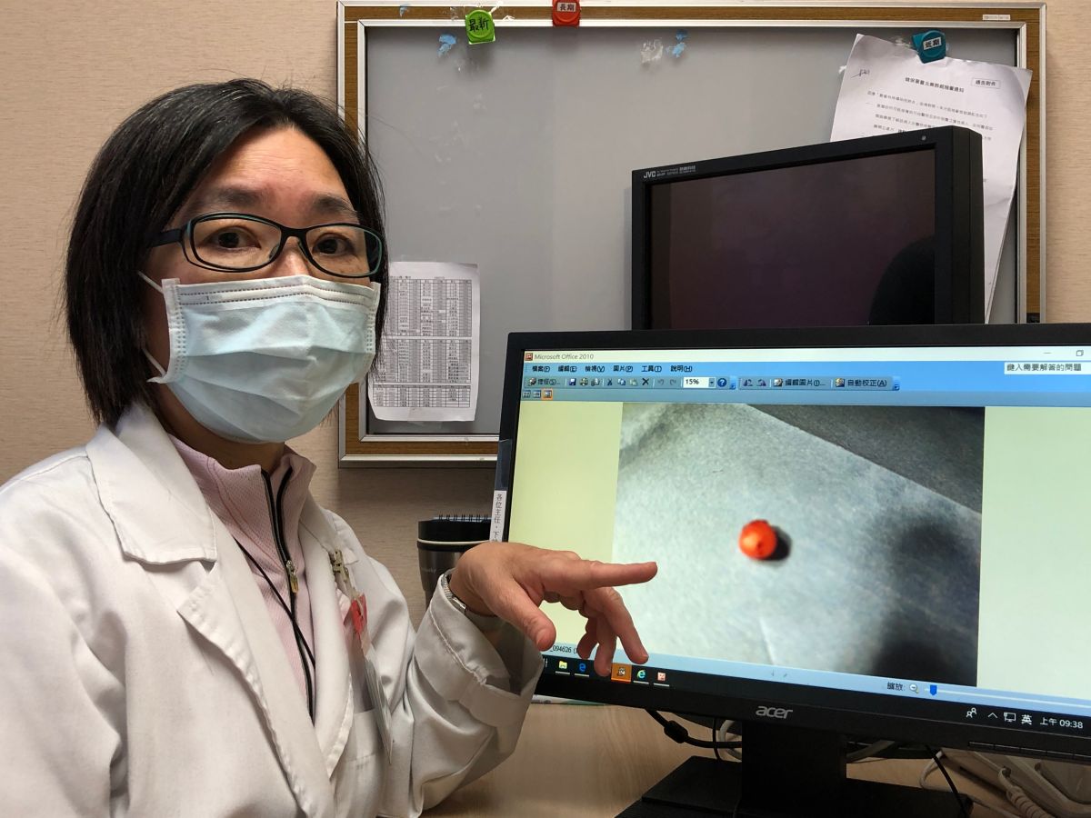 ▲日常生活中被撞擊挫傷難免，但書田診所整形美容科主任黃季怡提醒，如果沒有照護好傷口，當心因組織增生造成腫瘤影響到生活。（圖／書田診所提供）