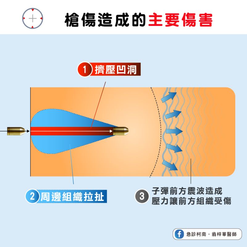 ▲槍傷造成的主要傷害有三點。(圖/急診柯南.翁梓華醫師授權提供)