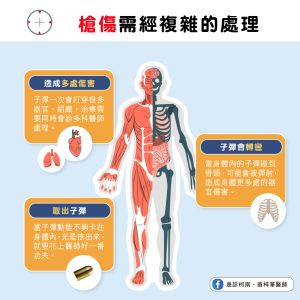 急診醫學上槍傷需經複雜的處理。(圖/急診柯南.翁梓華醫師授權提供) ▲急診醫學上槍傷需經複雜的處理。(圖/急診柯南.翁梓華醫師授權提供)