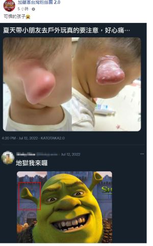 耳朵被蚊蟲咬傷腫起來 ▲有網友在臉書分享小朋友被蚊蟲叮咬的照片,耳朵腫脹變形,還被戲稱如同卡通人物史瑞克。(圖/翻攝臉書社團「加藤鷹台灣粉絲團2.0」)
