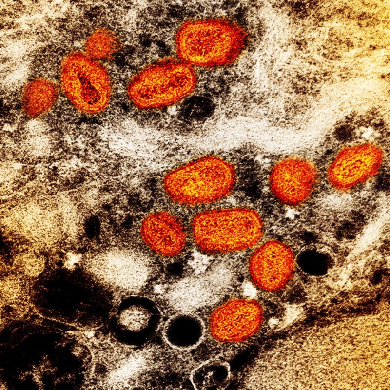 印度通報亞洲首起猴痘死亡病例　蘇丹出現首例確診