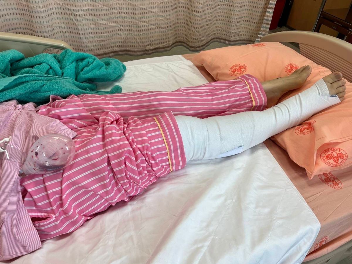 ▲盧秀燕腿傷手術後情況穩定，目前住院進行引流治療。（圖／台中市政府提供，2022.08.01）