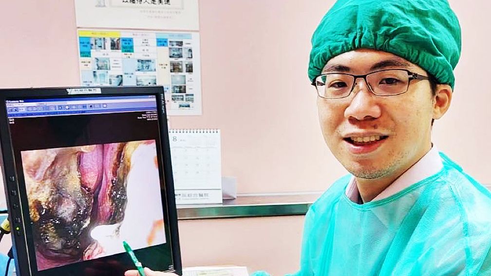 ▲造成鼻塞原因為「下鼻甲肥大」或「鼻中隔彎曲」，依照病人症狀及需求由醫師評估治療、手術方式。（圖／阮綜合醫院提供）