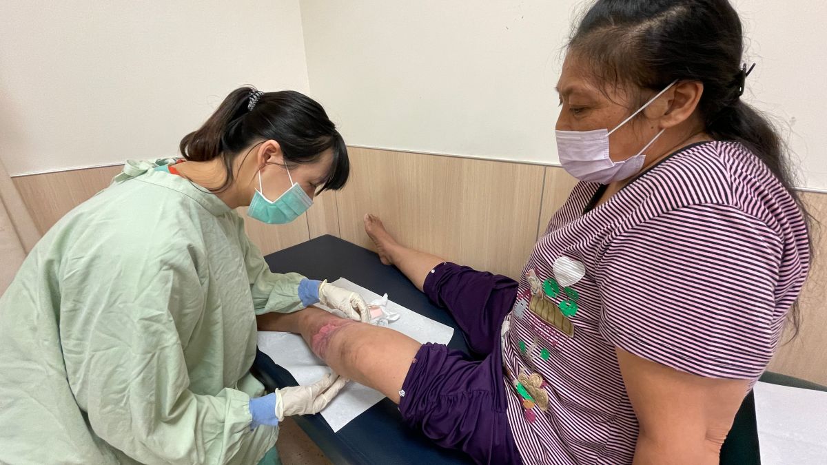 ▲整行外科團隊透過皮瓣手術降低傷口感染風險(圖／醫院提供2022.8.27)