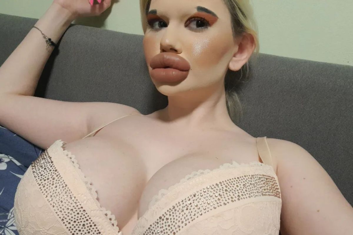 ▲想當真人版芭比，保加利亞女豐唇狂做30次，整形醫師無奈勸阻：「再整會堵住鼻孔」。（圖／Instagram：andrea88476）