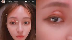 ▲林襄拍下自己眼睛腫大包的模樣,嚇壞許多粉絲。(圖/翻攝自林襄IG) ▲林襄拍下自己眼睛腫大包的模樣,嚇壞許多粉絲。(圖/翻攝自林襄IG)
