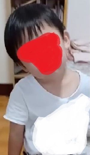 壓頭灌水、一分鐘餵10口飯 議員爆台中虐童案再現 ▲2歲男童從幼幼班放學後變成斜頸歪頭,整整住院一星期!(圖/林祈烽提供,2022.09.23)