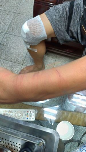 ▲新北市三重區一名男子,遭警方誤認是通緝犯當街被重毆打後心情難以平復。(圖/爆料公社公開版) ▲新北市三重區一名男子,遭警方誤認是通緝犯當街被重毆打後心情難以平復。(圖/爆料公社公開版)